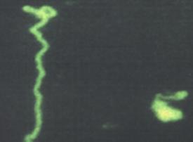 Other Tick-Borne Diseases