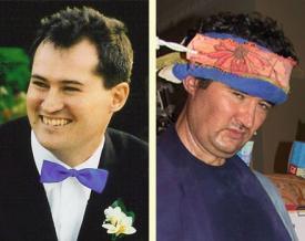 TOUCHED BY LYME: Foundation shines light on Lyme in Australia