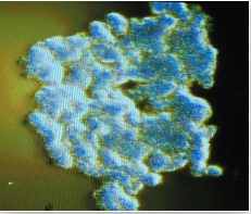 TOUCHED BY LYME:  A beauty contest for biofilms?