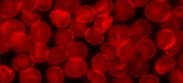 New test reveals viral history in single drop of blood