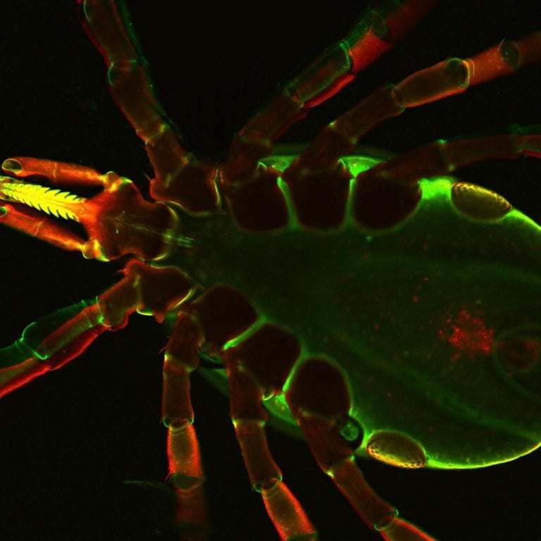 How Lyme bacteria can outsmart the human immune system