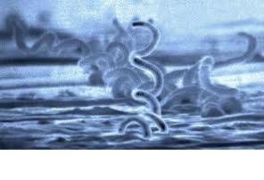 Infection found in treated patients with persistent Lyme symptoms