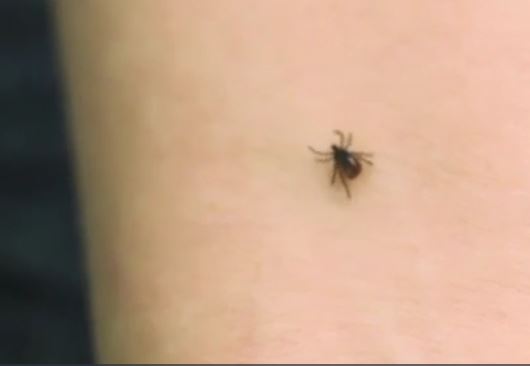 TOUCHED BY LYME: Michigan’s tick population is surging