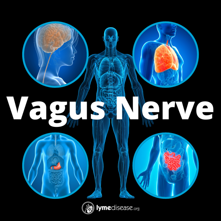 LYME SCI: Post-infectious fatigue and your vagus nerve