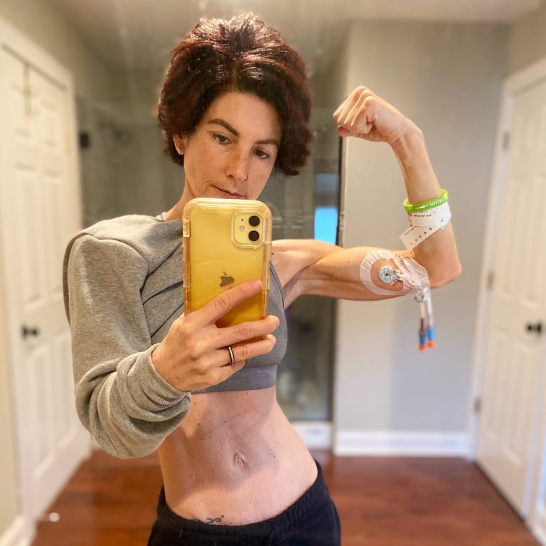 Patient story: Lyme disease deserves more than “mediocre attention”