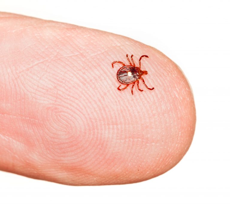 Patients with alpha-gal syndrome report wide range of symptoms