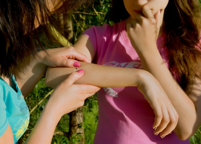 On what part of the your body are ticks most likely to bite?