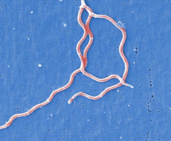 Which strains of Lyme disease cause the most severe symptoms?