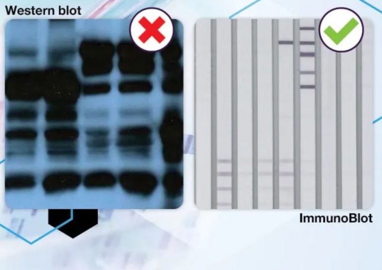 IGeneX to discontinue Western blots in favor of ImmunoBlot tests