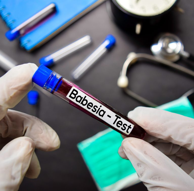 MEDICAL DETECTIVE #6: All about Babesia, aka “American malaria”