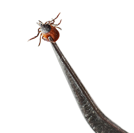 Tick Removal with Tweezers